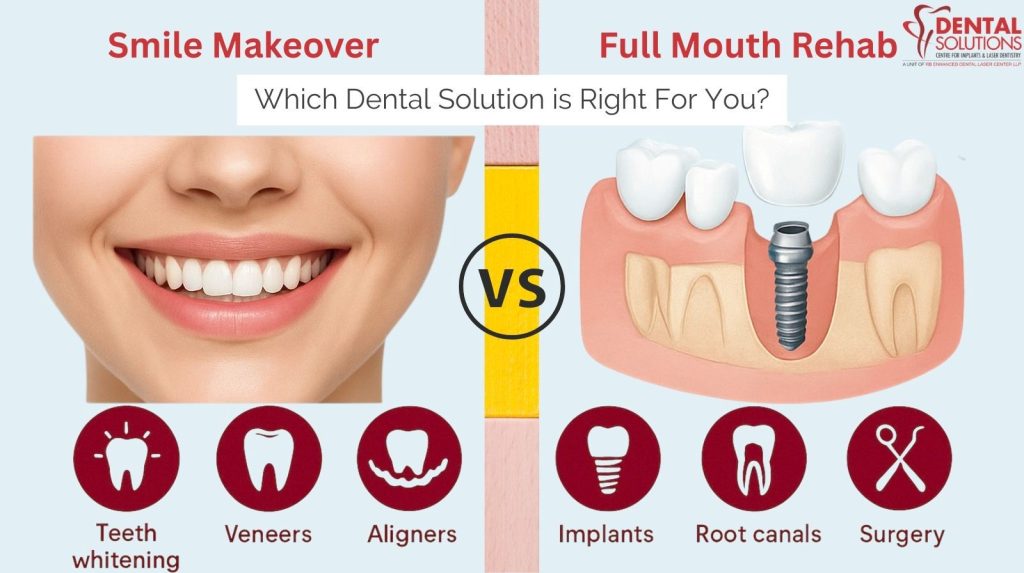 Comparison of Smile Makeover (whitening, veneers, aligners) versus Full Mouth Rehab (implants, root canals, surgery) showing the two dental solution paths.